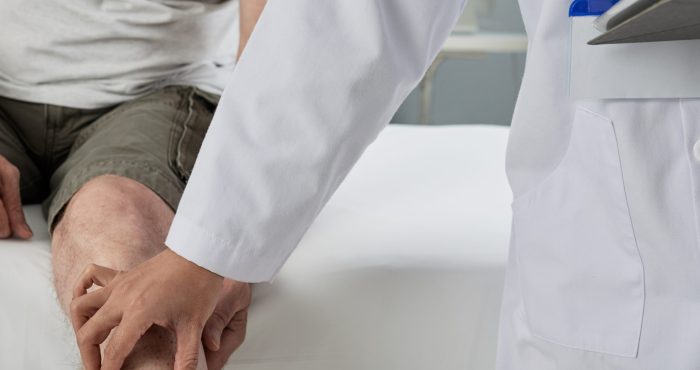 Arthrosamid Injections for Knee Arthritis Pain Relief