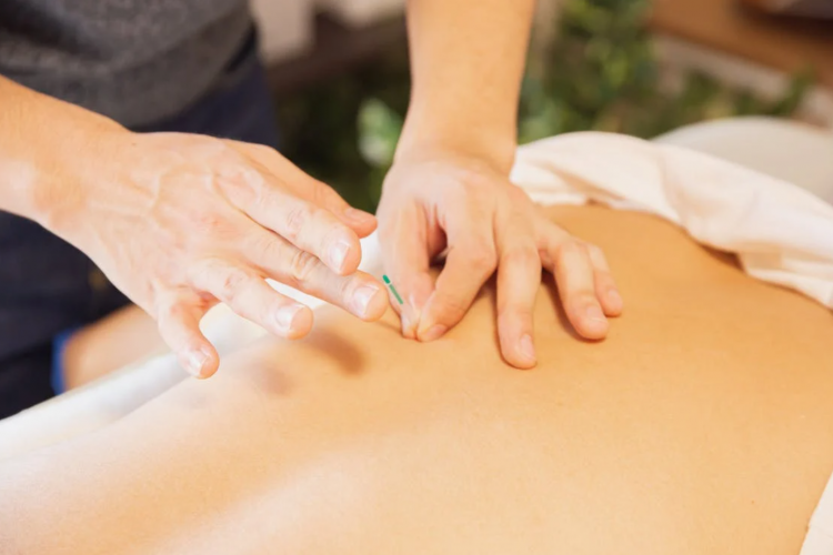 The Benefits of Acupuncture to the Side Effects of Breast Cancer Treatment