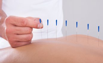 Benefits of Acupuncture as a Treatment Modality for Hip and Back Pain
