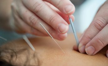 How Acupuncture Can Help with Arthritic Knee Pain